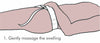 Inguinal Hernia Support Belt - Body Assist (1)